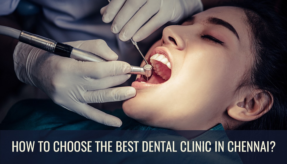 How to Choose the Best Dental Clinic in Chennai