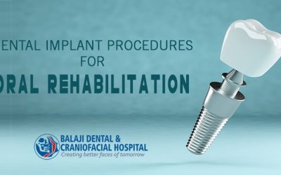 Dental Implant Procedures For Oral Rehabilitation
