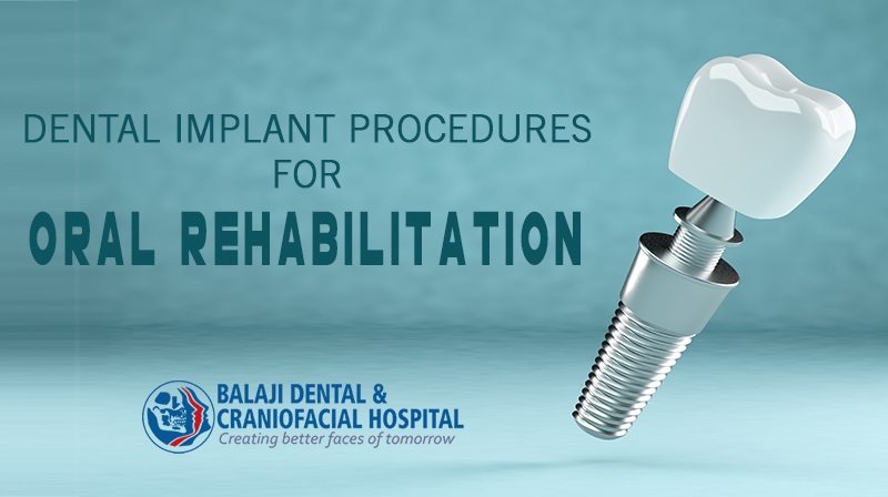 Dental Implant Procedures for Oral Rehabilitation