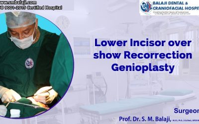 Lower Incisor Over Show Recorrection Genioplasty