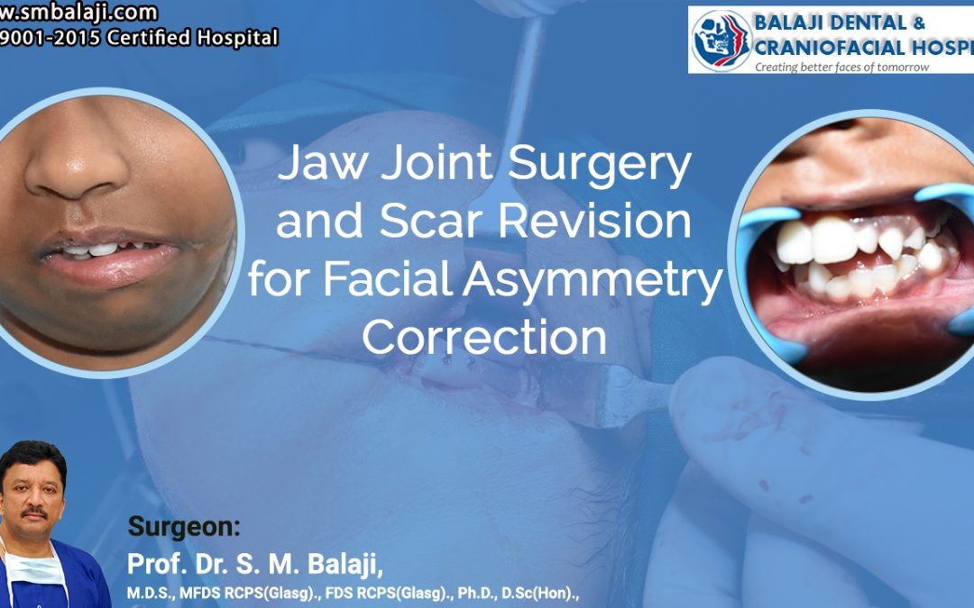 Revitalizing Facial Asymmetry: Jaw Joint Surgery and Scar Revision