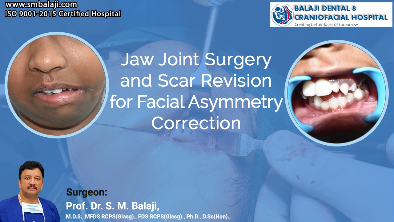 Jaw Joint Surgery And Scar Revision For Facial Asymmetry Correction