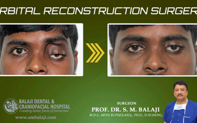 5 Heartwarming Stories Of Orbital Reconstruction Surgery In India.