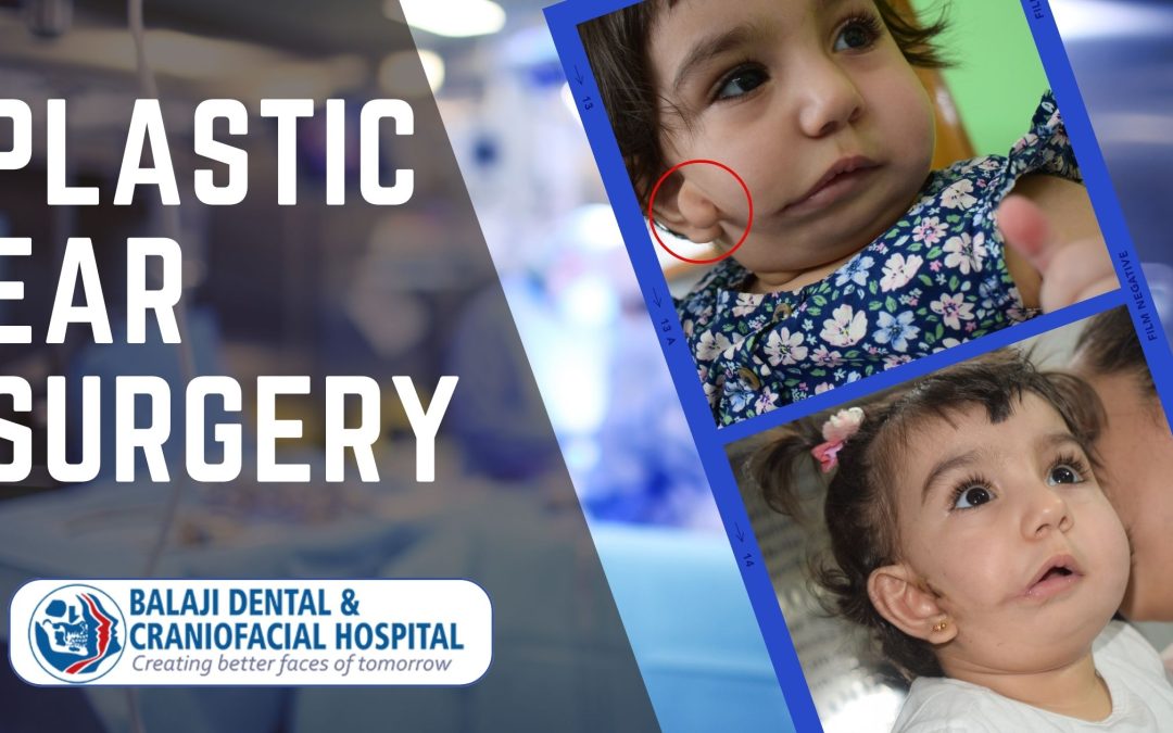 Transforming Lives: A Detailed Look at Plastic Ear Surgery in India – Outcomes, Recovery, and Cost