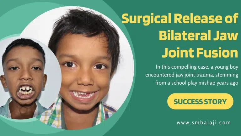Surgical Release Of Bilateral Jaw Joint Fusion