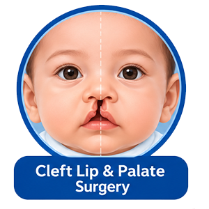 Cleft