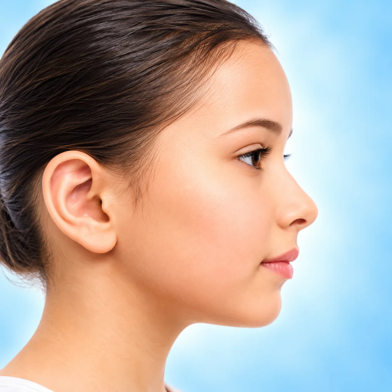 Hemifacial Microsomia